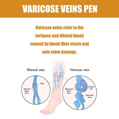 VeinEase Pen™